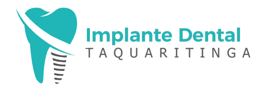 implante-dental-taquaritinga