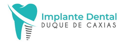 implante-dental-duque-caxias
