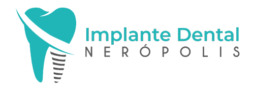implante-dental-Nerópolis