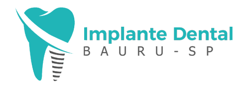 implante-dental-bauru