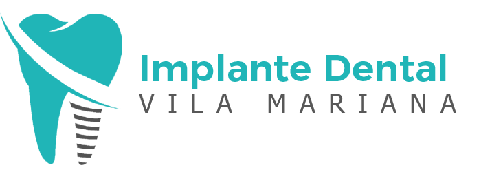 implante-dental-500-vila-mariana