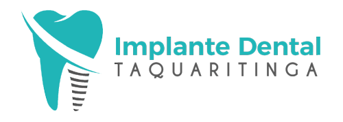implante-dental-taquaritinga-landscape