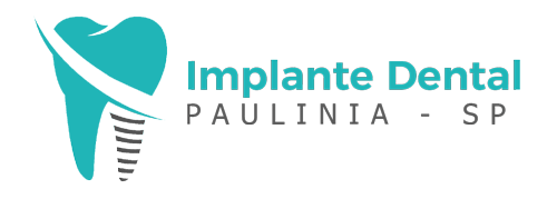 implante-dental-paulinia