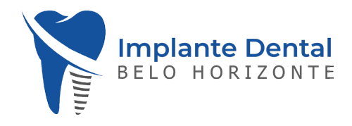 implante-dental-belo-horizonte