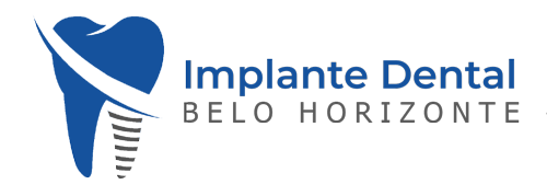 implante-dental-bh