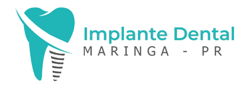 implante-dental-maringa