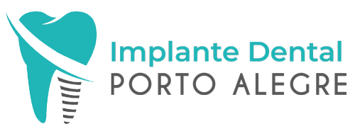 implante-dental-porto-alegre
