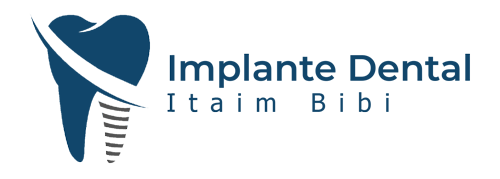 implante-dental-itaim-bibi