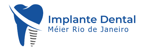 implante-dental-Meier