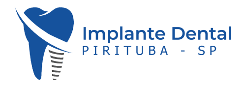 implante-dental-Pirituba