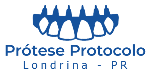 prótese-protocolo-londrina