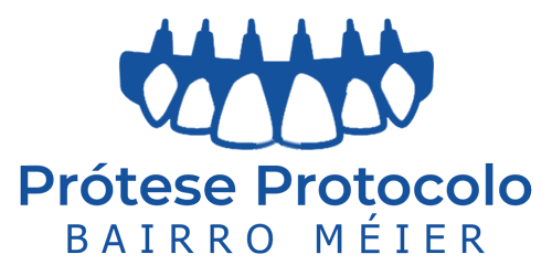 prótese-protocolo-rio-janeiro-Meier