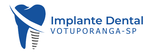 implante-dental-votuporanga