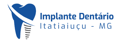 implante-dentario-itatiaiuçu