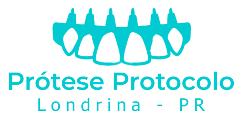 prótese-protocolo-londrina-dentista-angelica